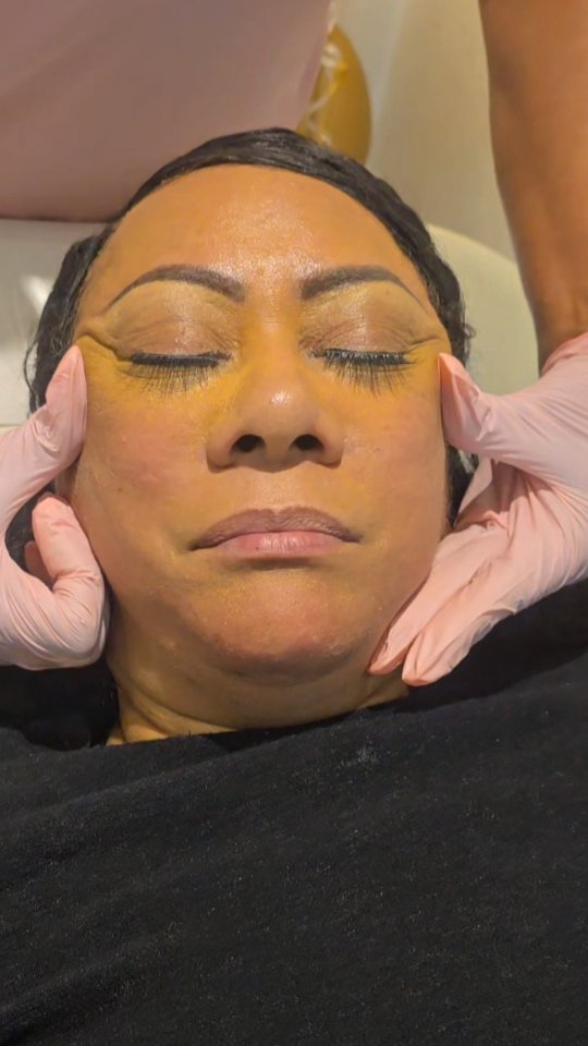 Antiwrinkle Treatments